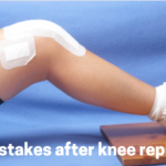 top 5 mistakes after knee replacement