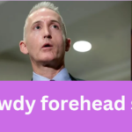 trey gowdy forehead surgery