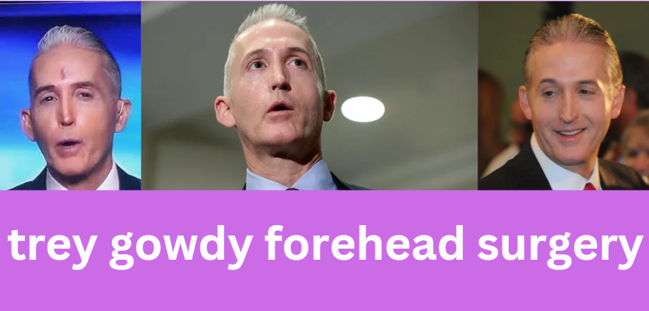 trey gowdy forehead surgery